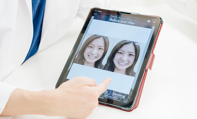 デジタルによる理想のスマイル診断